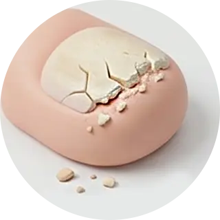 무좀 발톱 케이스 2 무좀 발톱 케이스 2